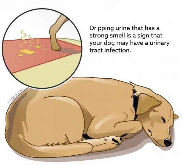 Infections de la vessie et infections des voies urinaires