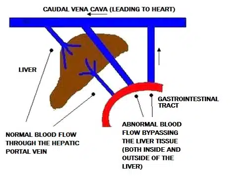 Șunt hepatic