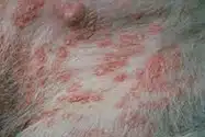 pyoderma