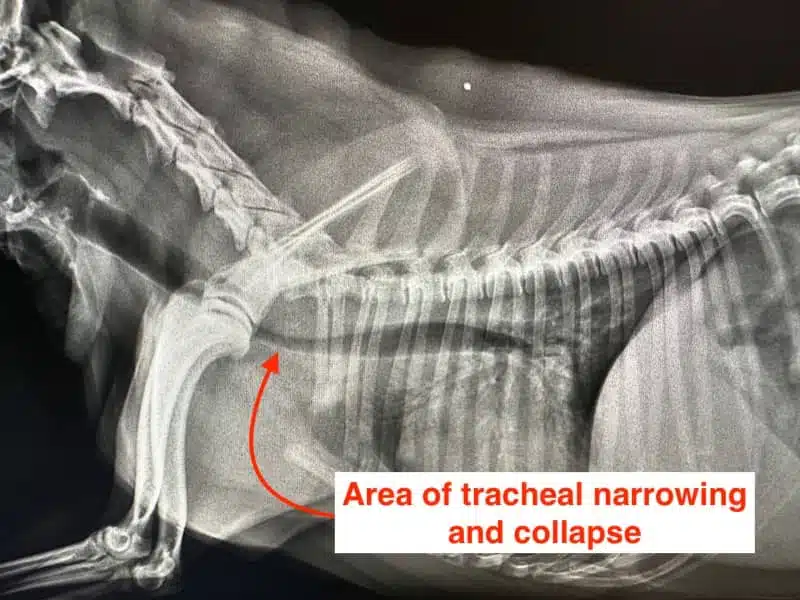 Tracheal Zesummebroch