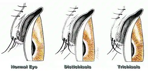 Dog Eye Hair Problems