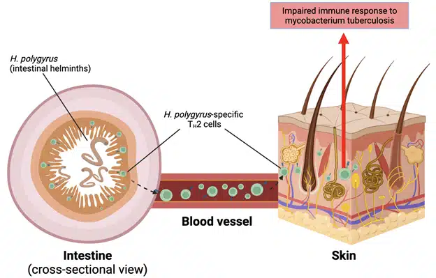 Maladies intestinales et cutanées