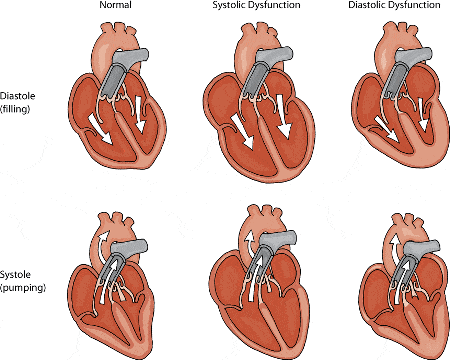 Heart disease in dogs