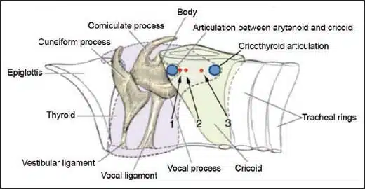 Laryngeal Lähmung