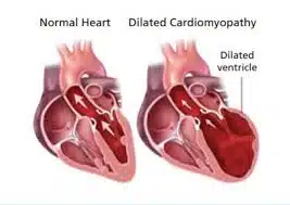 Heart disease in dogs