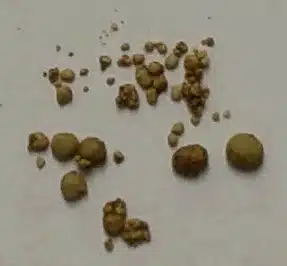 Kidney stones in dogs