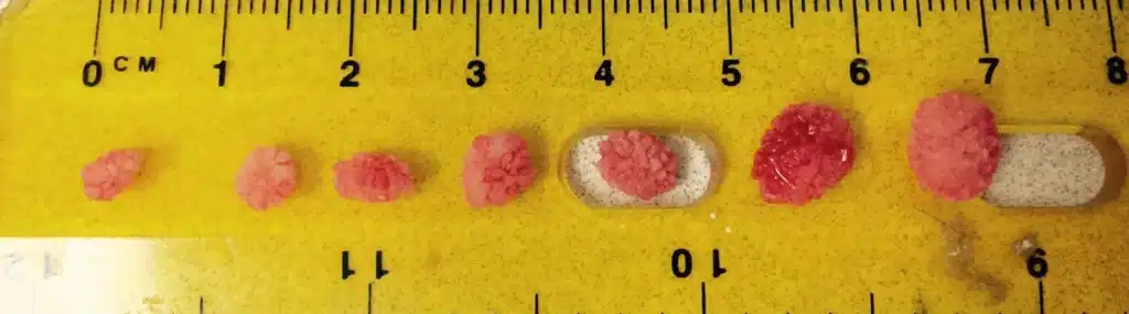 Urinary stone in cats