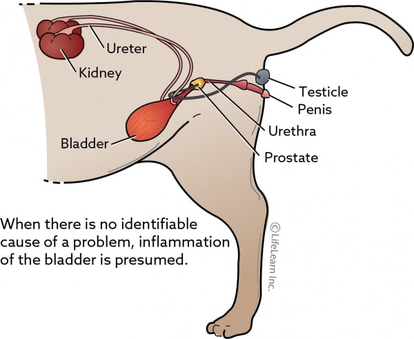 cistitis idiopática