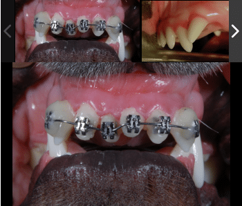 Orthodontics in cats