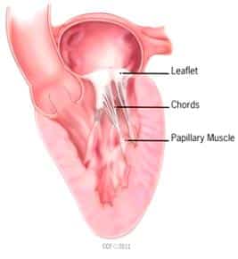 Mitral Endokardiose bei Hënn