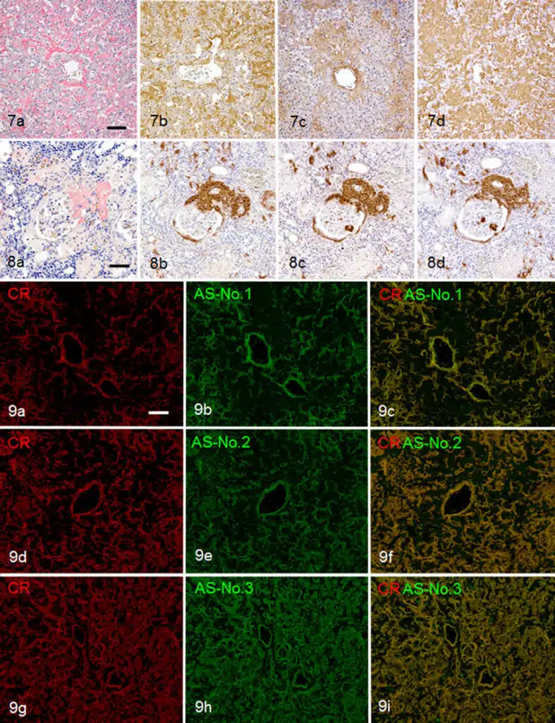 Amyloidosis in cats