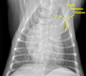 Pulomnal stenosis in dogs