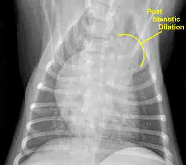 Estenosis pulmonar en perros