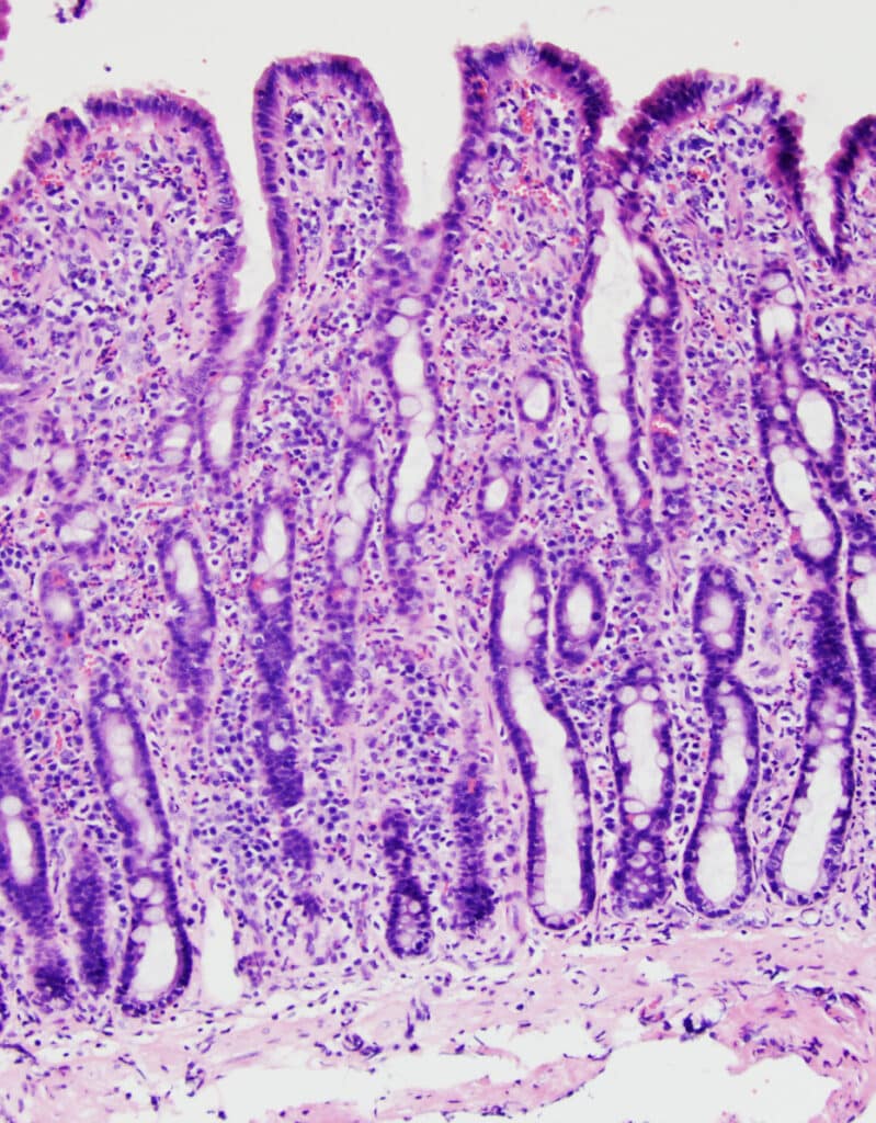 고양이의 IBD